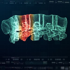 3D spinal scan with highlighted injury area, illustrating (VMA) benefits - Evident Health